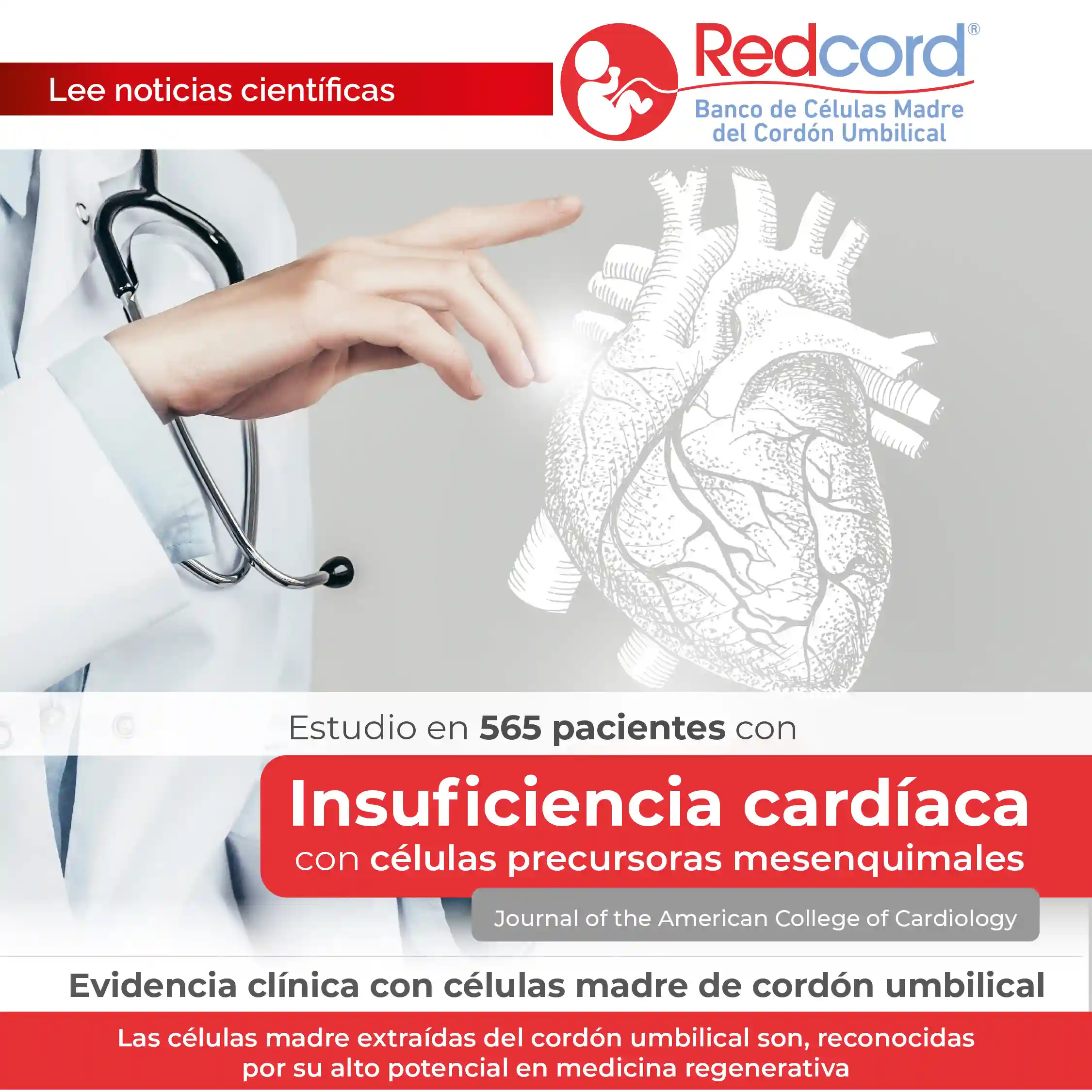 Un estudio clínico multicéntrico en 565 pacientes con insuficiencia cardíaca con fracción de eyección reducida evaluó el uso de células precursoras mesenquimales, analizando su seguridad, efectos antiinflamatorios y su impacto en la microcirculación.